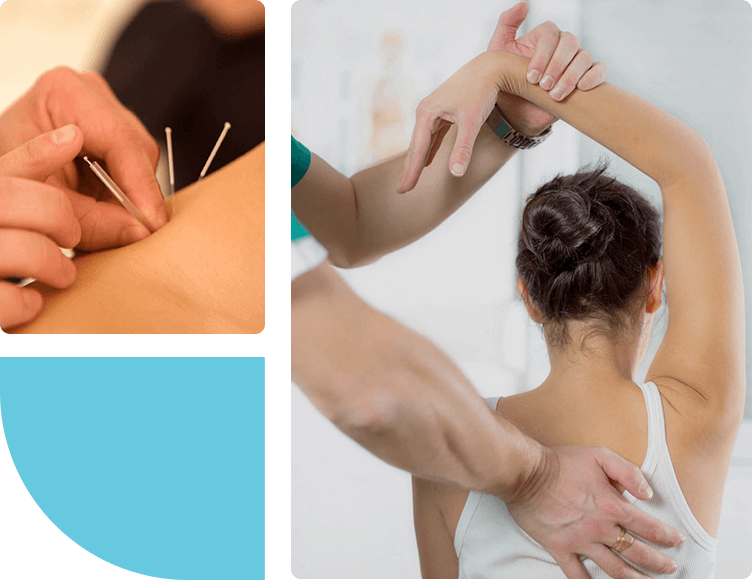 Collage of a person receiving acupuncture and physiotherapist treating her patient's arm